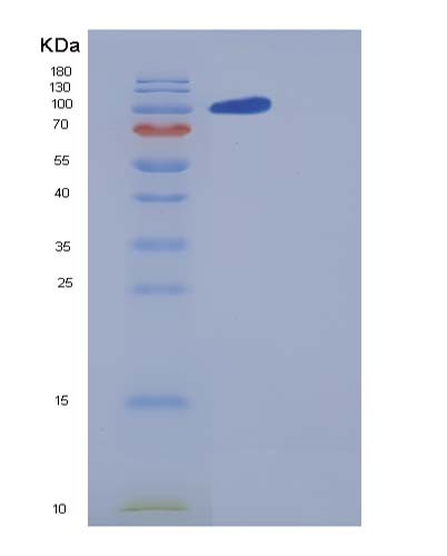 SDS-PAGE analysis of Human CNTN5 (Contactin-5) - Recombinant Protein, showing >85% purity under 15% SDS-PAGE (Reduced)