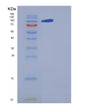 SDS-PAGE analysis of Human CNTN5 (Contactin-5) - Recombinant Protein, showing >85% purity under 15% SDS-PAGE (Reduced)