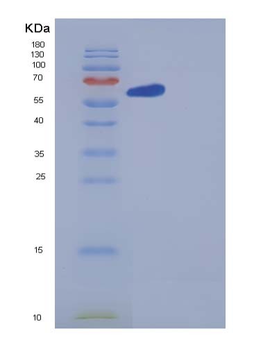 SDS-PAGE analysis of Human GBP1 (Guanylate-Binding Protein 1) - Recombinant Protein, showing >95% purity under 15% SDS-PAGE (Reduced)