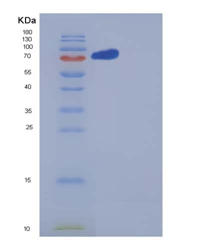 SDS-PAGE analysis of Human NRP2 (Neuropilin-2) - Recombinant Protein, showing >90% purity under 15% SDS-PAGE (Reduced)