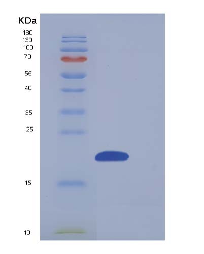 SDS-PAGE analysis of Human NUDT2 (Bis(5'-Nucleosyl)-Tetraphosphatase [Asymmetrical]) - Recombinant Protein, showing >90% purity under 15% SDS-PAGE (Reduced)