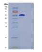 SDS-PAGE analysis of Human SMYD3 (Histone-Lysine N-Methyltransferase Smyd3) - Recombinant Protein, showing >85% purity under 15% SDS-PAGE (Reduced)