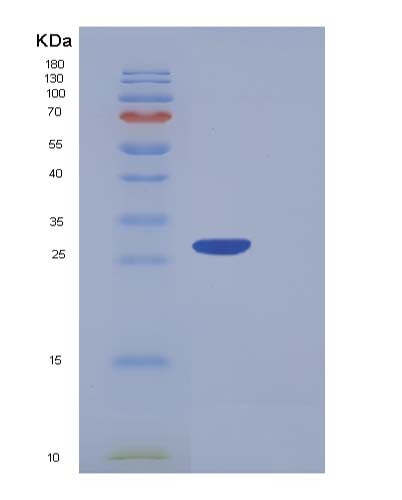 SDS-PAGE analysis of Human PF4V1 (Platelet Factor 4 Variant) - Recombinant Protein, showing >85% purity under 15% SDS-PAGE (Reduced)