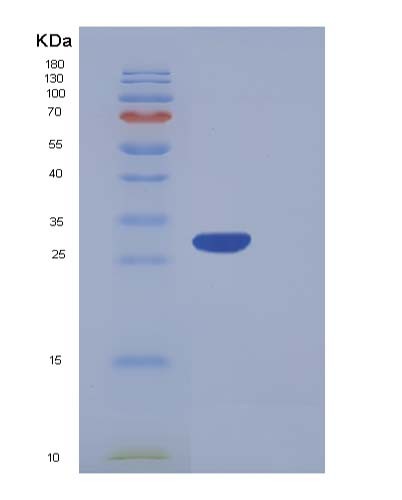 SDS-PAGE analysis of Human CA5A (Carbonic Anhydrase 5A, Mitochondrial) - Recombinant Protein, showing >95% purity under 15% SDS-PAGE (Reduced)