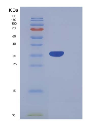 SDS-PAGE analysis of Human PRRG2 (Transmembrane Gamma-Carboxyglutamic Acid Protein 2) - Recombinant Protein, showing >90% purity under 15% SDS-PAGE (Reduced)
