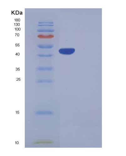 SDS-PAGE analysis of Human CPA2 (Carboxypeptidase A2) - Recombinant Protein, showing >95% purity under 15% SDS-PAGE (Reduced)