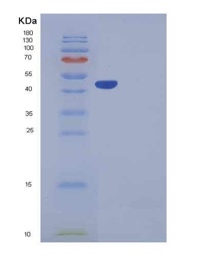 SDS-PAGE analysis of Mouse Serpinb6b - Recombinant Protein, showing >85% purity under 15% SDS-PAGE (Reduced)