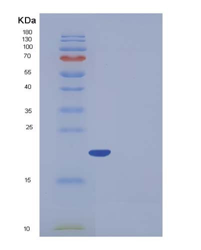 SDS-PAGE analysis of Human FTL (Ferritin Light Chain) - Recombinant Protein, showing >95% purity under 15% SDS-PAGE (Reduced)