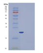 SDS-PAGE analysis of Human FTL (Ferritin Light Chain) - Recombinant Protein, showing >95% purity under 15% SDS-PAGE (Reduced)