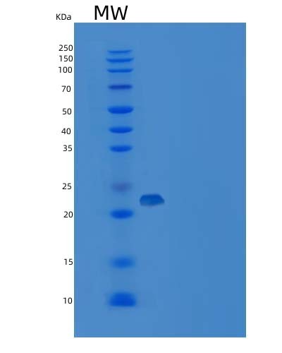 SDS-PAGE analysis of Human PRDM2 (Pr Domain Zinc Finger Protein 2) - Recombinant Protein, showing >85% purity under 15% SDS-PAGE (Reduced)