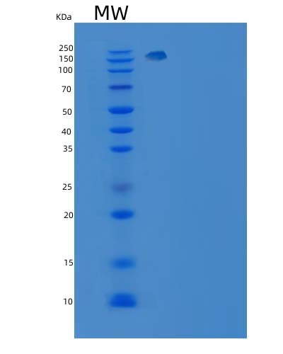 SDS-PAGE analysis of Human ITGA6 (Integrin Alpha-6) - Recombinant Protein, CAT# BLT-08420P showing >90% purity under 15% SDS-PAGE (Reduced)