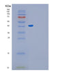 SDS-PAGE analysis of Human GLUL (Glutamine Synthetase) - Recombinant Protein, showing >95% purity under 15% SDS-PAGE (Reduced)