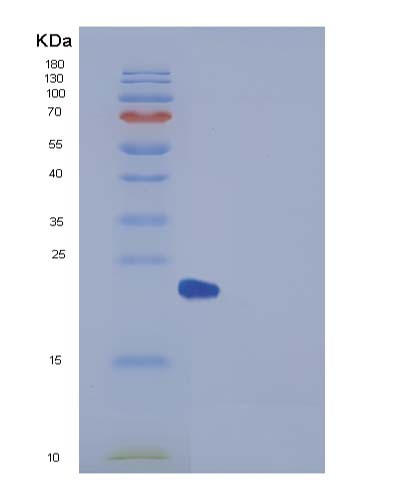 SDS-PAGE analysis of Human UBE2H (Ubiquitin-Conjugating Enzyme E2 H) - Recombinant Protein, showing >95% purity under 15% SDS-PAGE (Reduced)