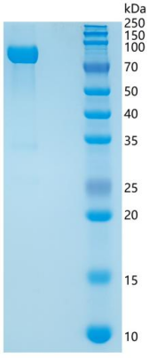 SDS-PAGE analysis of Human SLITRK1 (Slit And Ntrk-Like Protein 1) - Recombinant Protein, showing >90% purity under 15% SDS-PAGE (Reduced)