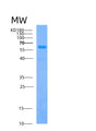 SDS-PAGE analysis of Human BLK (Tyrosine-Protein Kinase Blk) - Recombinant Protein, showing >85% purity under 15% SDS-PAGE (Reduced)