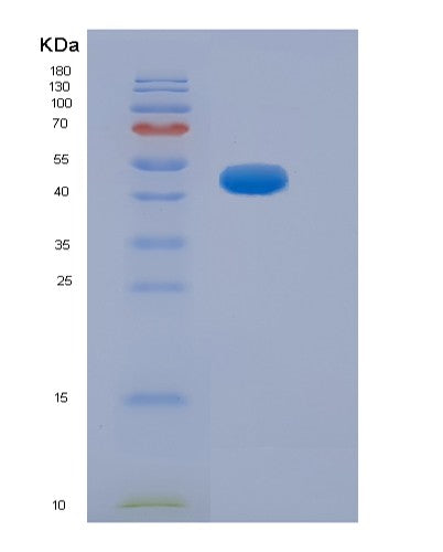 SDS-PAGE analysis of Human NEFH (Neurofilament Heavy Polypeptide) - Recombinant Protein, showing >95% purity under 15% SDS-PAGE (Reduced)