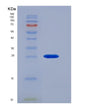 SDS-PAGE analysis of Mouse Csf1r (Macrophage Colony-Stimulating Factor 1 Receptor) - Recombinant Protein, showing >95% purity under 15% SDS-PAGE (Reduced)