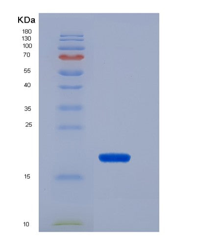 SDS-PAGE analysis of Human P2RX7 (P2X Purinoceptor 7) - Recombinant Protein, CAT# BLT-08448P showing >90% purity under 15% SDS-PAGE (Reduced)