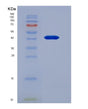 SDS-PAGE analysis of Human Resistin Like Beta (RETNLb) - Recombinant Protein, showing >95% purity under 15% SDS-PAGE (Reduced)