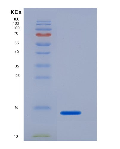 SDS-PAGE analysis of Mouse Tubgcp2 (Gamma-Tubulin Complex Component 2) - Recombinant Protein, showing >95% purity under 15% SDS-PAGE (Reduced)