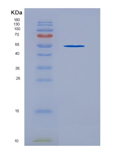SDS-PAGE analysis of Human TEK (Angiopoietin-1 Receptor) - Recombinant Protein, showing >80% purity under 15% SDS-PAGE (Reduced)