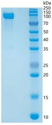 SDS-PAGE analysis of Human GLB1 (Beta-Galactosidase) - Recombinant Protein, CAT# BLT-08440P showing >95% purity under 15% SDS-PAGE (Reduced)