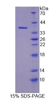 SDS-PAGE analysis of Human KEAP1 (Kelch-Like Ech-Associated Protein 1) - Recombinant Protein, showing >90% purity under 15% SDS-PAGE (Reduced)