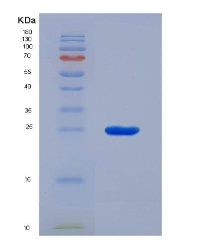 SDS-PAGE analysis of Human MMP9 (Matrix Metalloproteinase-9) - Recombinant Protein, showing >95% purity under 15% SDS-PAGE (Reduced)