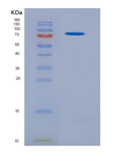 SDS-PAGE analysis of Human CSF1 (Macrophage Colony-Stimulating Factor 1) - Recombinant Protein, showing >90% purity under 15% SDS-PAGE (Reduced)