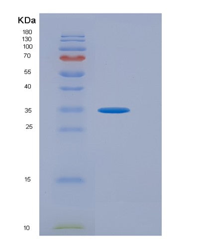 SDS-PAGE analysis of Human ATF4 (Cyclic Amp-Dependent Transcription Factor Atf-4) - Recombinant Protein, showing >95% purity under 15% SDS-PAGE (Reduced)