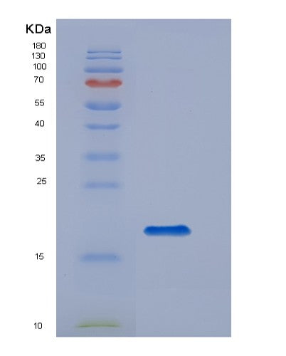 SDS-PAGE analysis of Human CD14 (Monocyte Differentiation Antigen Cd14) - Recombinant Protein, showing >95% purity under 15% SDS-PAGE (Reduced)