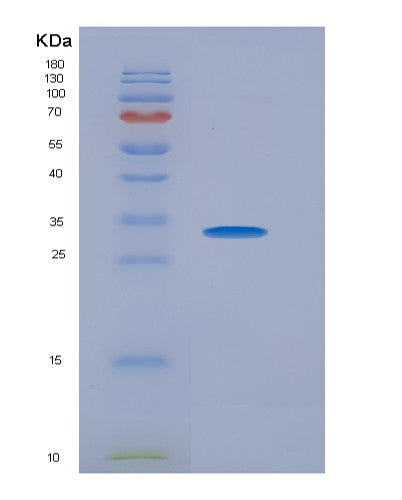 SDS-PAGE analysis of Mouse Cd200r1 (Cell Surface Glycoprotein Cd200 Receptor 1) - Recombinant Protein, showing >90% purity under 15% SDS-PAGE (Reduced)