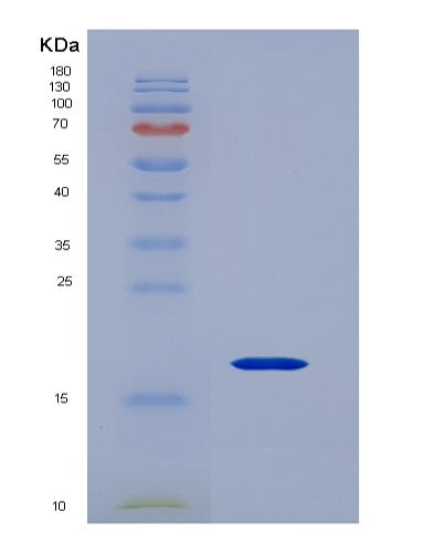 SDS-PAGE analysis of Human CD247 (T-Cell Surface Glycoprotein Cd3 Zeta Chain) - Recombinant Protein, showing >95% purity under 15% SDS-PAGE (Reduced)
