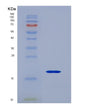 SDS-PAGE analysis of Human CD247 (T-Cell Surface Glycoprotein Cd3 Zeta Chain) - Recombinant Protein, showing >95% purity under 15% SDS-PAGE (Reduced)