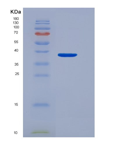 SDS-PAGE analysis of Mouse Cd274 (Programmed Cell Death 1 Ligand 1) - Recombinant Protein, showing >85% purity under 15% SDS-PAGE (Reduced)