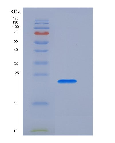 SDS-PAGE analysis of Human CD3E (T-Cell Surface Glycoprotein Cd3 Epsilon Chain) - Recombinant Protein, showing >95% purity under 15% SDS-PAGE (Reduced)