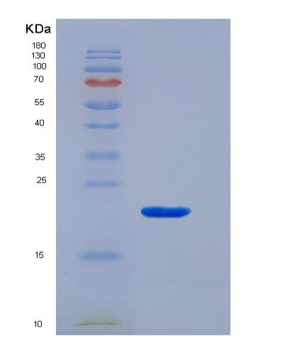 SDS-PAGE analysis of Human CD3G (T-Cell Surface Glycoprotein Cd3 Gamma Chain) - Recombinant Protein, showing >90% purity under 15% SDS-PAGE (Reduced)