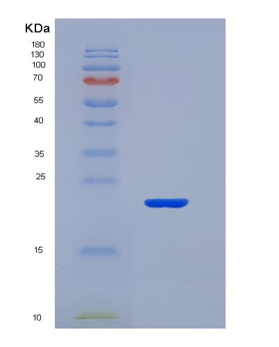 SDS-PAGE analysis of Human CD40 (Tumor Necrosis Factor Receptor Superfamily Member 5) - Recombinant Protein, showing >95% purity under 15% SDS-PAGE (Reduced)