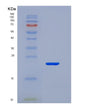 SDS-PAGE analysis of Human CD40 (Tumor Necrosis Factor Receptor Superfamily Member 5) - Recombinant Protein, showing >95% purity under 15% SDS-PAGE (Reduced)