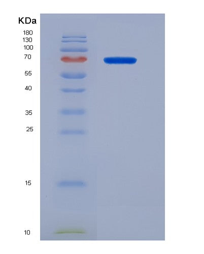 SDS-PAGE analysis of Human CD68 (Macrosialin) - Recombinant Protein, showing >95% purity under 15% SDS-PAGE (Reduced)