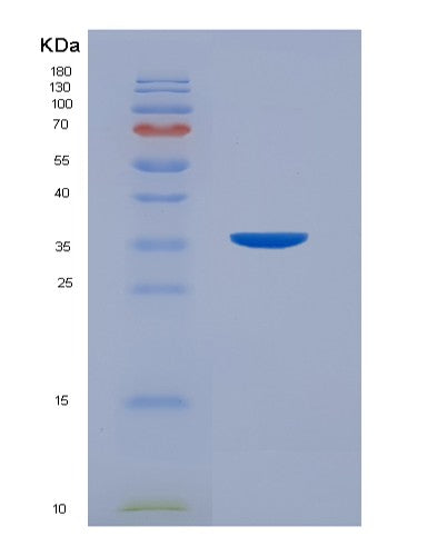 SDS-PAGE analysis of Human CD7 (T-Cell Antigen Cd7) - Recombinant Protein, showing >95% purity under 15% SDS-PAGE (Reduced)