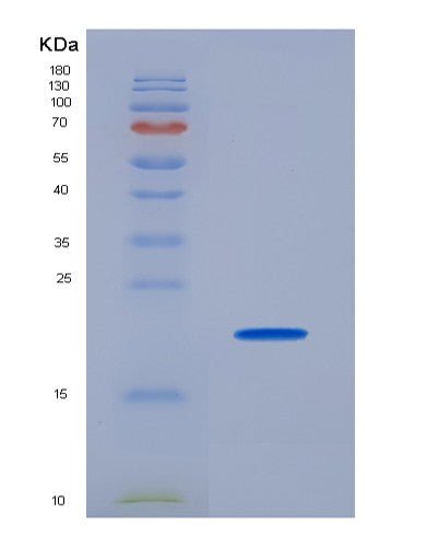 SDS-PAGE analysis of Human CD74 (Hla Class Ii Histocompatibility Antigen Gamma Chain) - Recombinant Protein, showing >95% purity under 15% SDS-PAGE (Reduced)