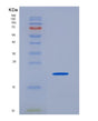 SDS-PAGE analysis of Human CD74 (Hla Class Ii Histocompatibility Antigen Gamma Chain) - Recombinant Protein, showing >95% purity under 15% SDS-PAGE (Reduced)