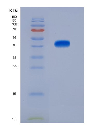 SDS-PAGE analysis of Human CD74 (Hla Class Ii Histocompatibility Antigen Gamma Chain) - Recombinant Protein, showing >95% purity under 15% SDS-PAGE (Reduced)