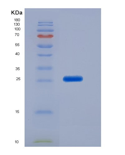 SDS-PAGE analysis of Human CD79B (B-Cell Antigen Receptor Complex-Associated Protein Beta Chain) - Recombinant Protein, showing >95% purity under 15% SDS-PAGE (Reduced)