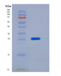 SDS-PAGE analysis of Human CD79B (B-Cell Antigen Receptor Complex-Associated Protein Beta Chain) - Recombinant Protein, showing >95% purity under 15% SDS-PAGE (Reduced)