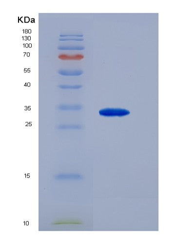 SDS-PAGE analysis of Human CD79B (B-Cell Antigen Receptor Complex-Associated Protein Beta Chain) - Recombinant Protein, showing >90% purity under 15% SDS-PAGE (Reduced)