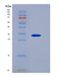 SDS-PAGE analysis of Human CD79B (B-Cell Antigen Receptor Complex-Associated Protein Beta Chain) - Recombinant Protein, showing >90% purity under 15% SDS-PAGE (Reduced)