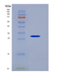 SDS-PAGE analysis of Human CD84 (Slam Family Member 5) - Recombinant Protein, showing >95% purity under 15% SDS-PAGE (Reduced)