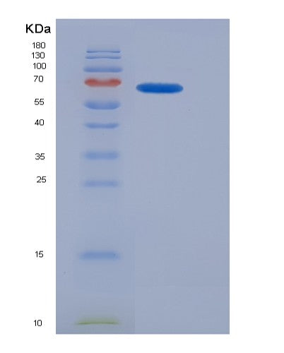SDS-PAGE analysis of Human CCN2 (Ccn Family Member 2) - Recombinant Protein, showing >80% purity under 15% SDS-PAGE (Reduced)